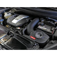 Takeda Momentum Pro DRY S Cold Air Intake System (Veloster 13-17)